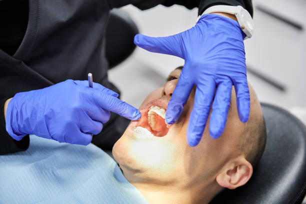 Best Dentist for Tooth Abscess  in Brocton, NY